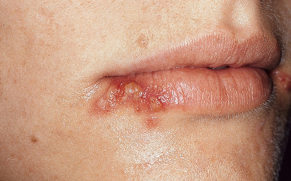 how to stop waking up with extremely dry mouth
