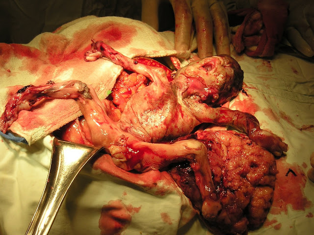 how to tell babys position in uterus