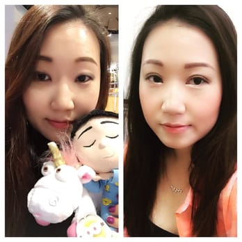 how to stop your eyelid from double folding after sleep