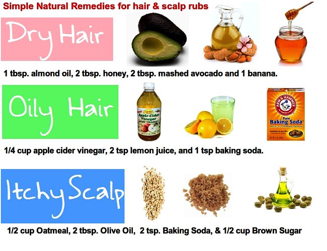 how to stop dry scalp flakes