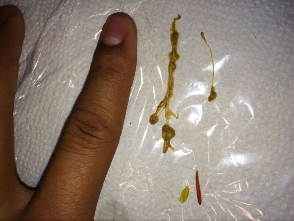 how to tell if parasite cleanse is working