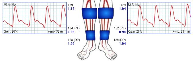 how to take pulse in ankle